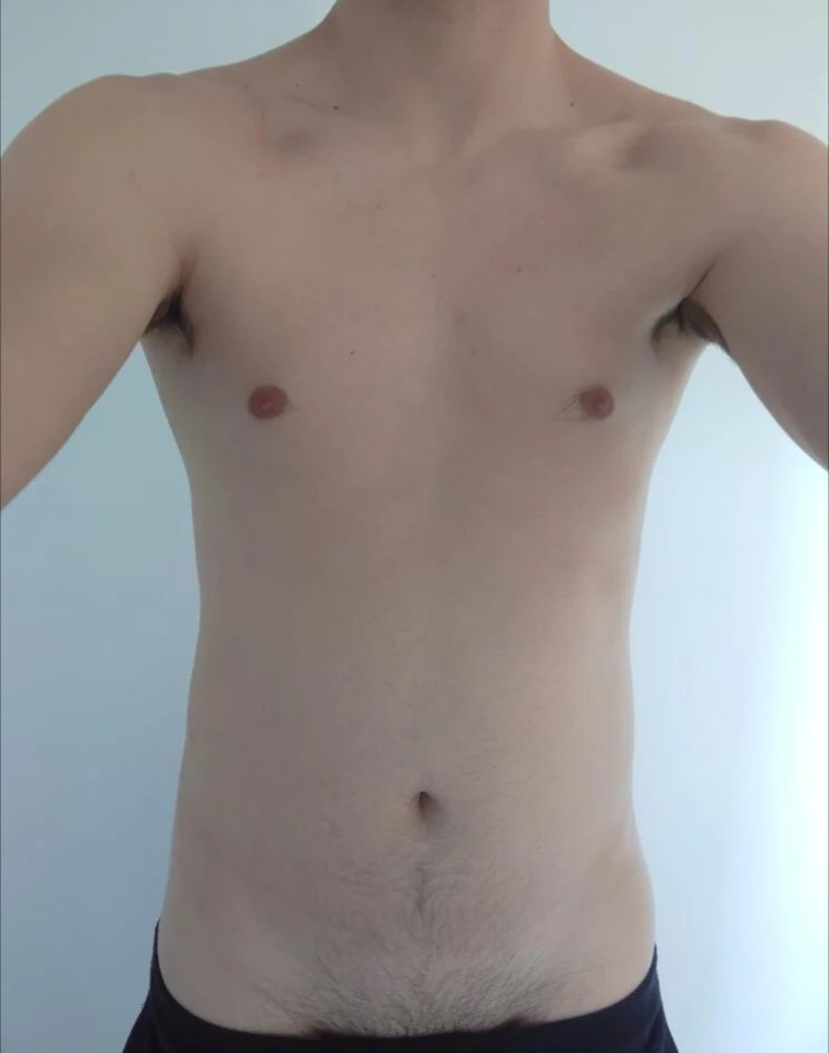 Profil de Hypolyte